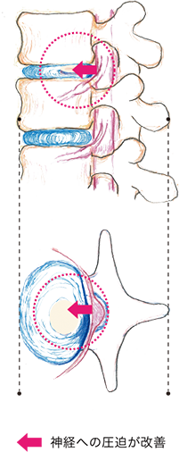 治療後の図